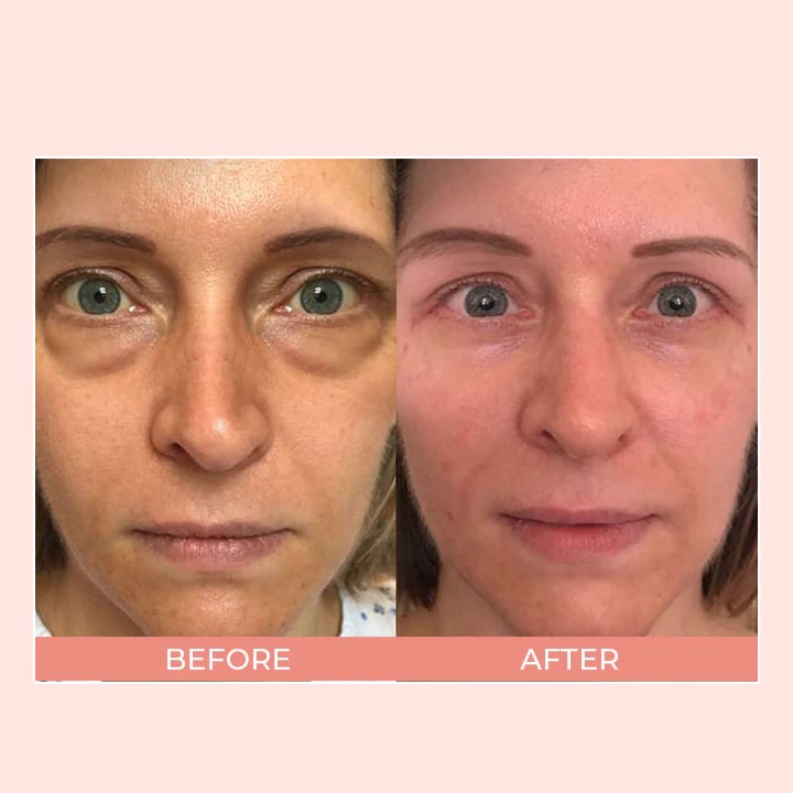 Retinol Eye Cream Stickš„BUY 2 GET 1 FREE