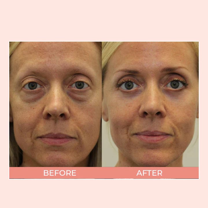 Retinol Eye Cream Stick🔥BUY 2 GET 1 FREE